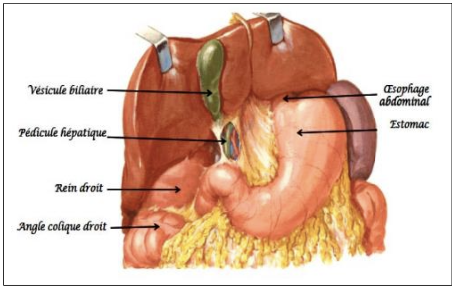 Description of image